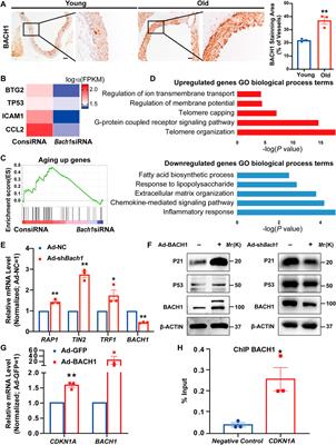 Single-Cell Analysis Identify Transcription Factor BACH1 as a Master Regulator Gene in Vascular Cells During Aging